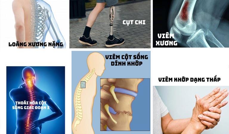 Xương khớp nằm trong 13 nhóm bệnh không được tham gia XKLĐ tại Nhật